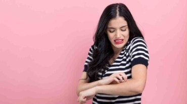 Home remedies for mosquito bites