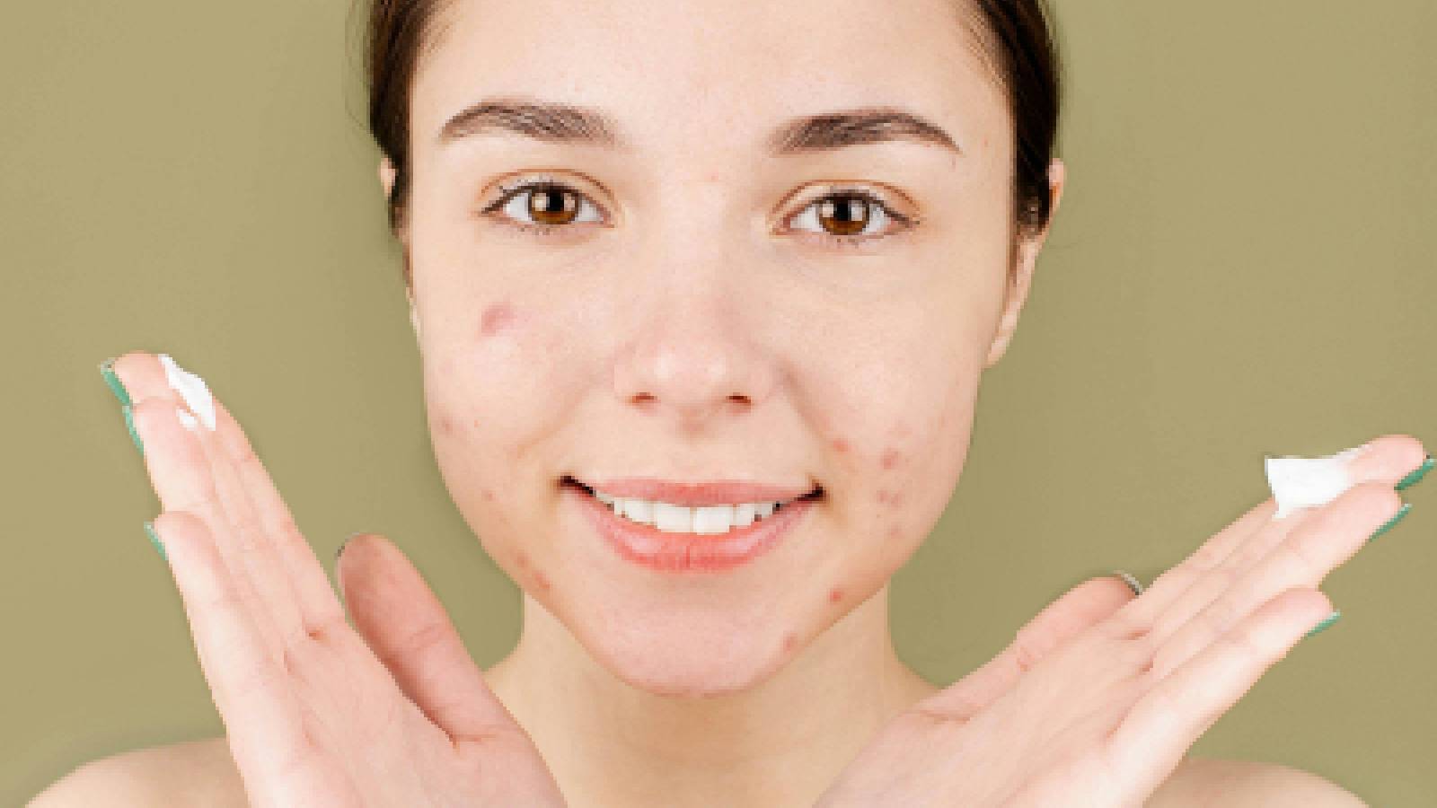 A woman applying moisturiser with tretinoin on her face