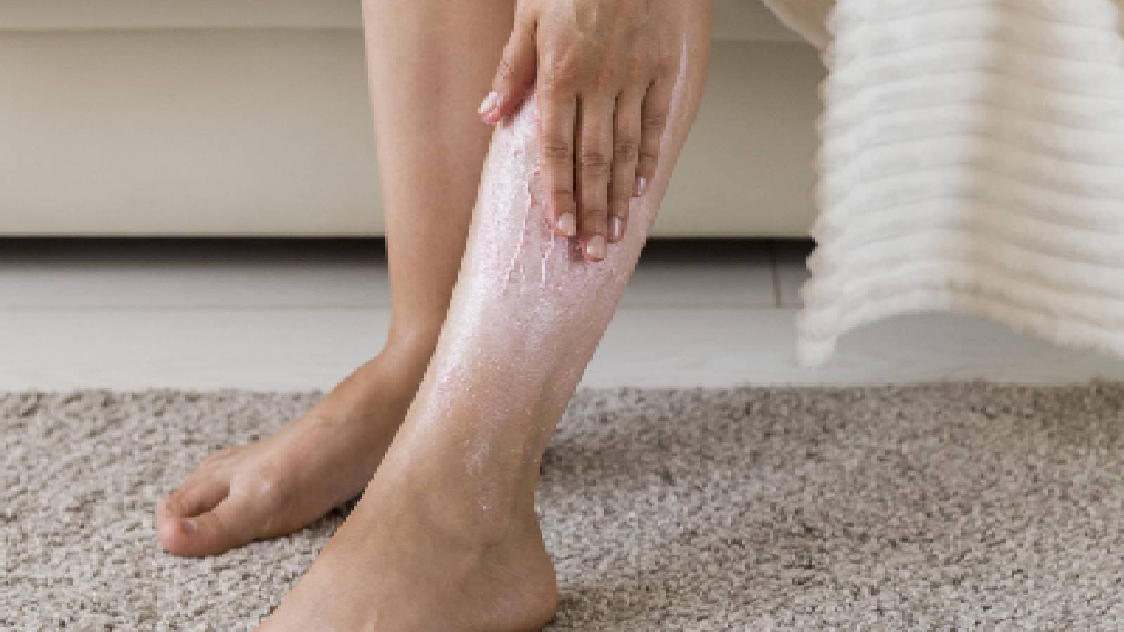 A woman spreading cream on her legs