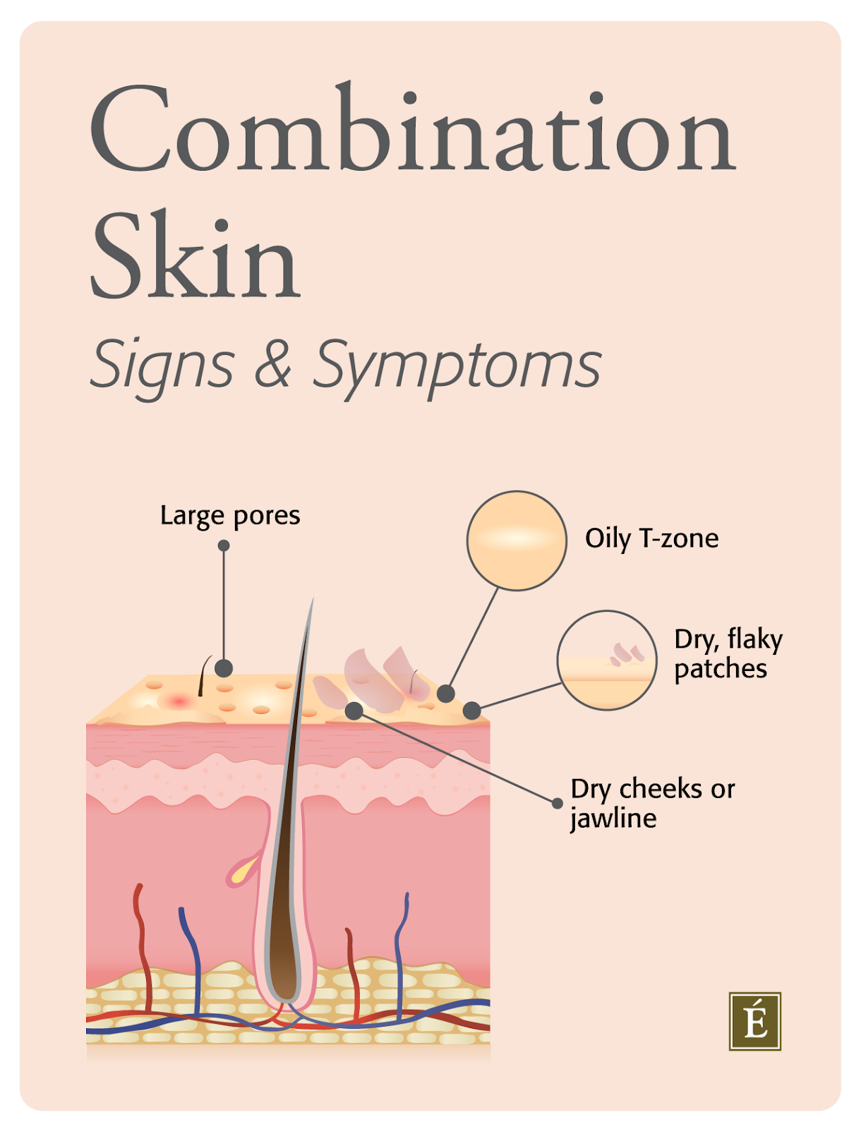 Combination Skin Signs and Symptoms