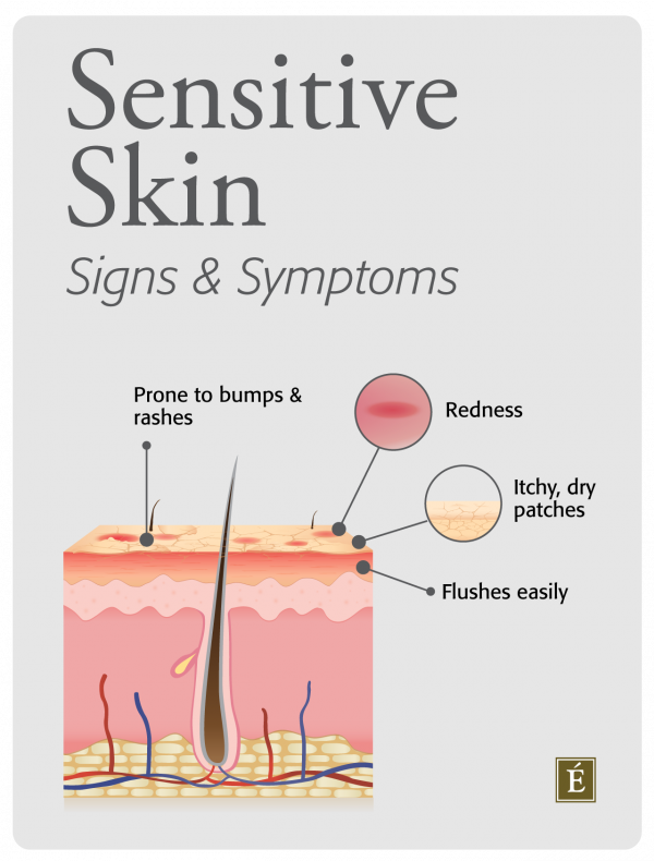 Sensitive Skin Care The Signs Symptoms