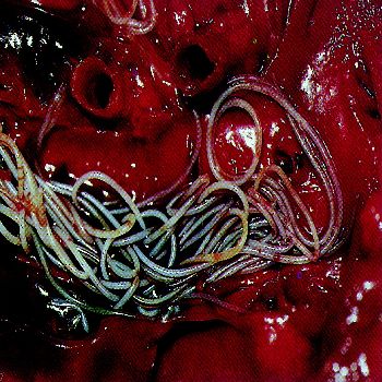 An absolutely horrifying picture of live heartworms from inside a dog's heart.